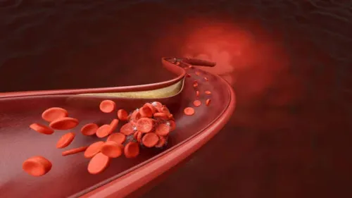 Resténose coronaire intra-stent